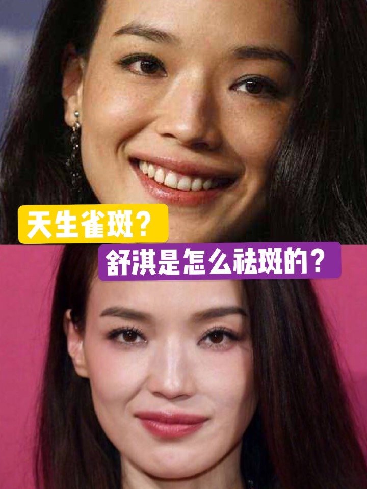 明星里也有长斑的,像舒淇,她也长了斑点,之前晒过的照片里看着很明显.