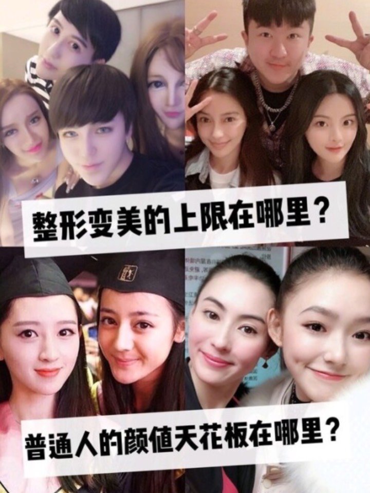 普通人的颜值和整容美的上限都在哪里呢?