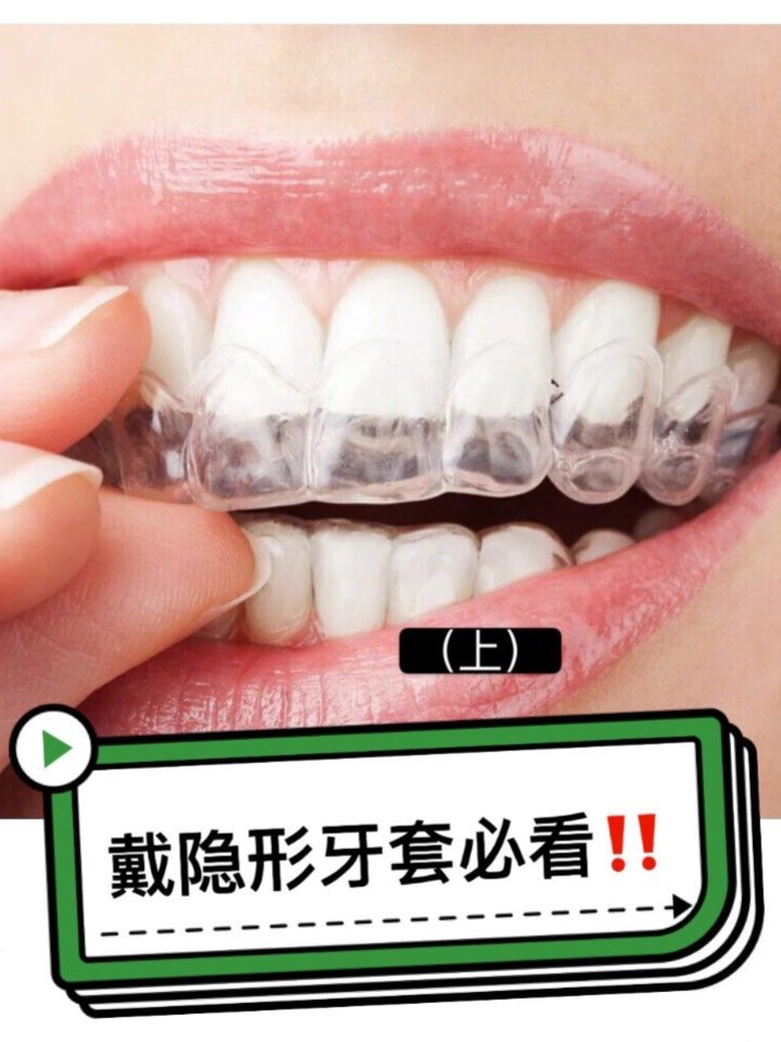 你不知道的隐形牙套原来有正畸效果这么好(上)