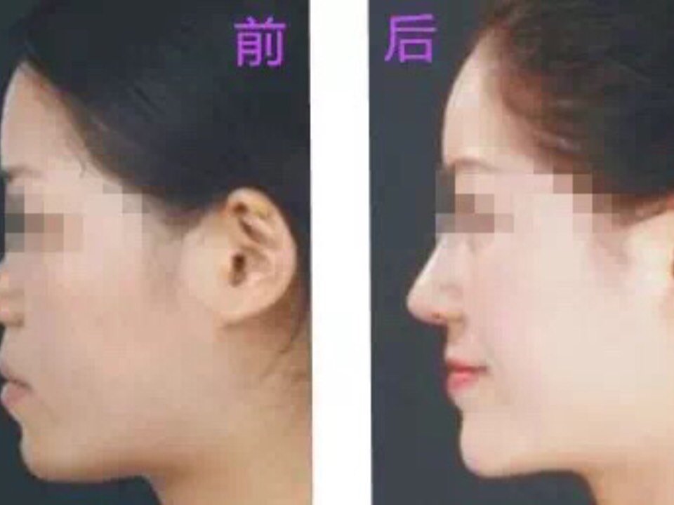 如果鼻梁与鼻头丰满有肉的,则一生财运颇佳,而鼻梁尖肖露骨的,则苛刻