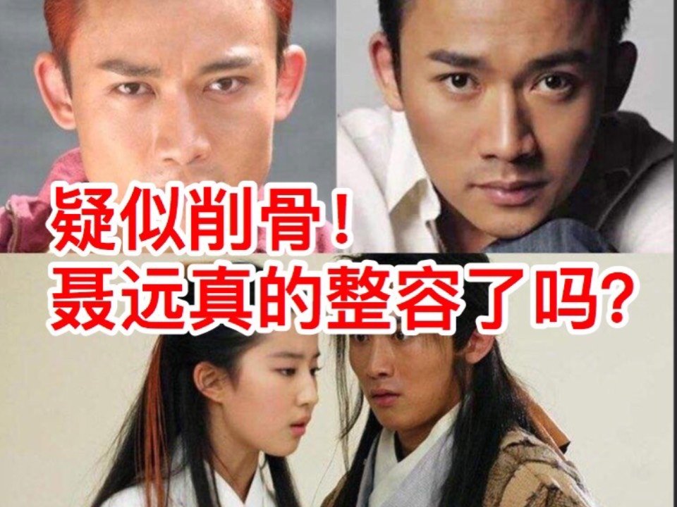 疑似削骨,聂远真的整容了吗