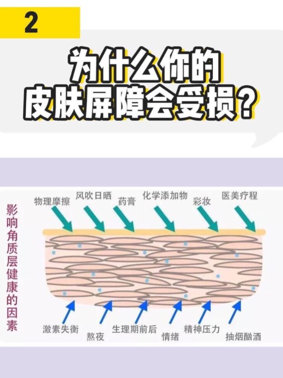 皮肤屏障受损的原因主要分为两个方面 1内源性:先天皮肤屏障功能有