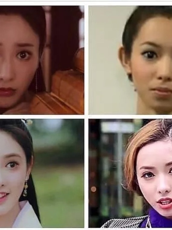 做整容要讲顺序吗?彭小苒"的变美过程算是一个常规版