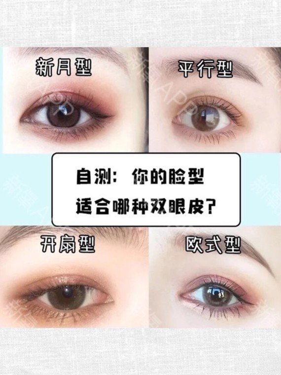双眼皮类型 ,看看你更适合哪一种双眼皮呢