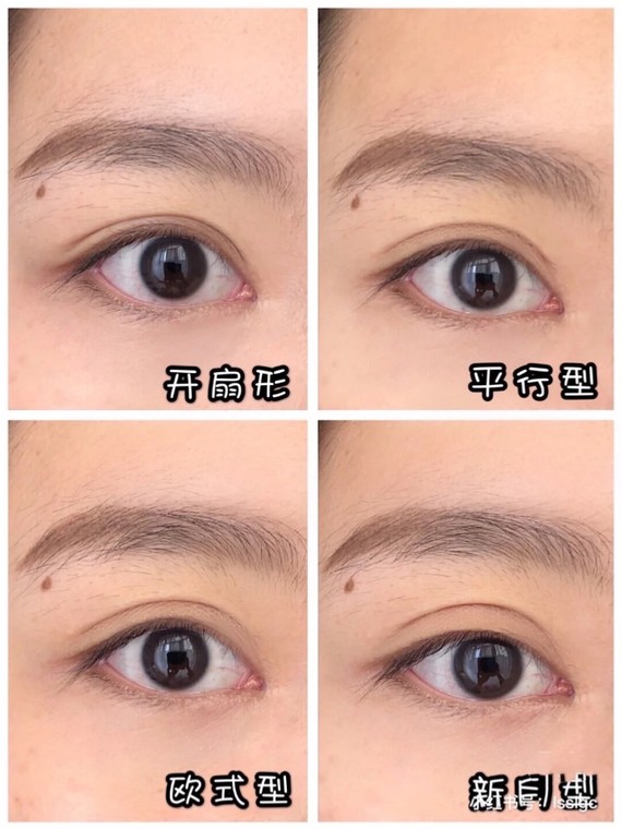 一般来说,根据双眼皮上眼睑睑缘之间的宽度,可以分为4类:新月型,开扇