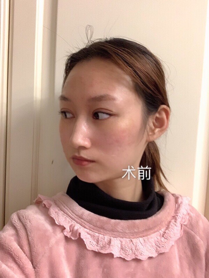 说到美女的脸型,现在的审美取向是瓜子脸,再往前推一点呢,是鹅蛋脸.