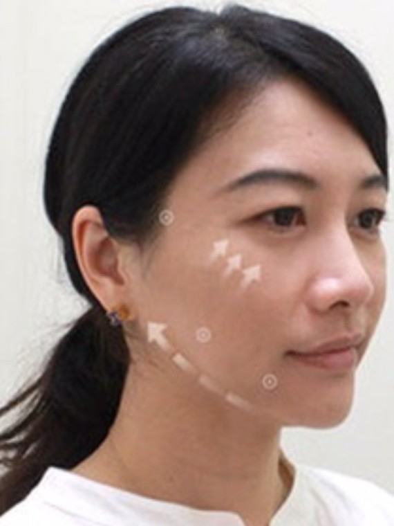 让人看起来超级显老的木偶纹,你有吗?