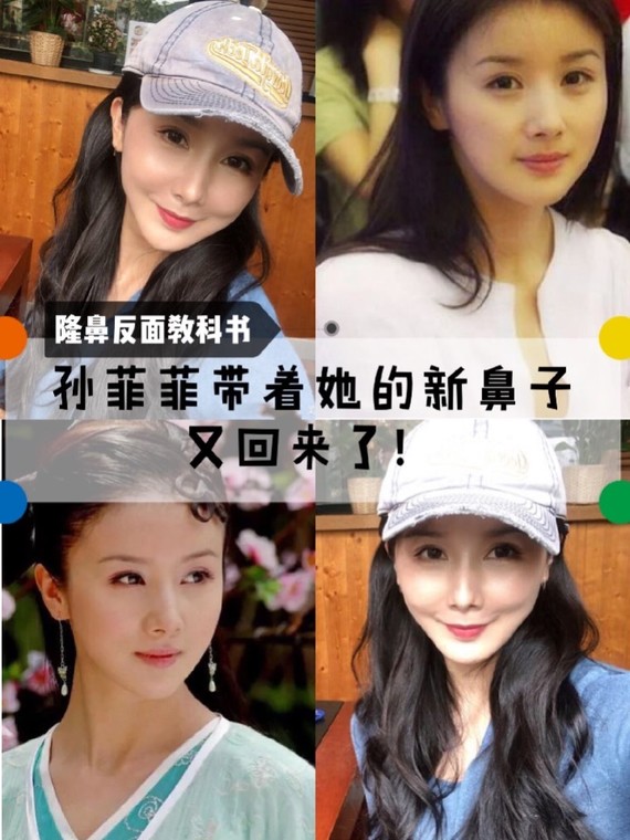 每次提到整容毁容的女明星都会提_圈子-新氧美容整形