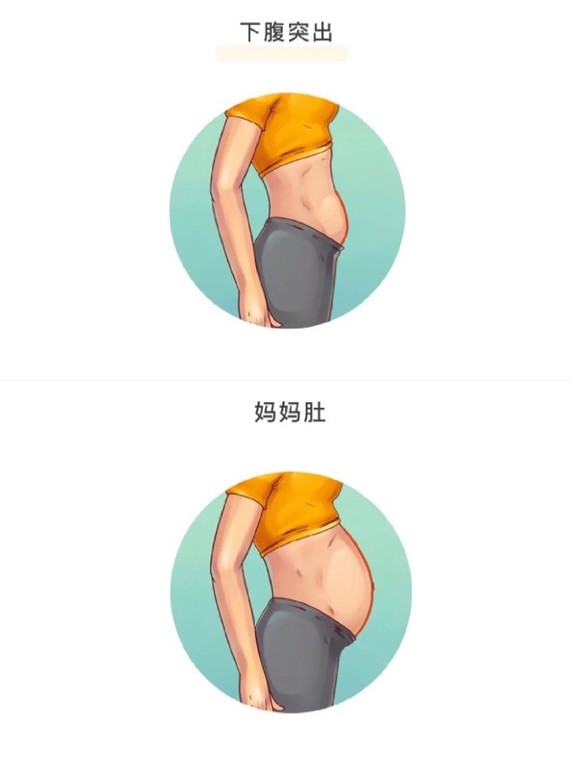 这几种难减的大肚腩,快看看有你没