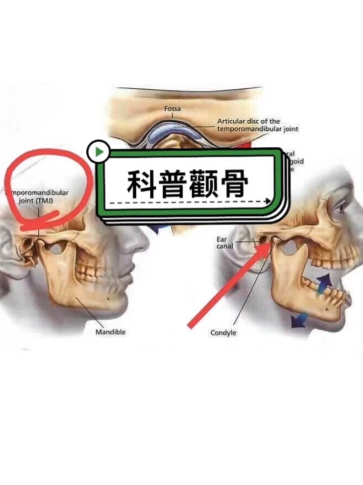 贴 1下颌骨喙突a到额弓之间的距离2从正面看,后端截 骨线处b的宽窄