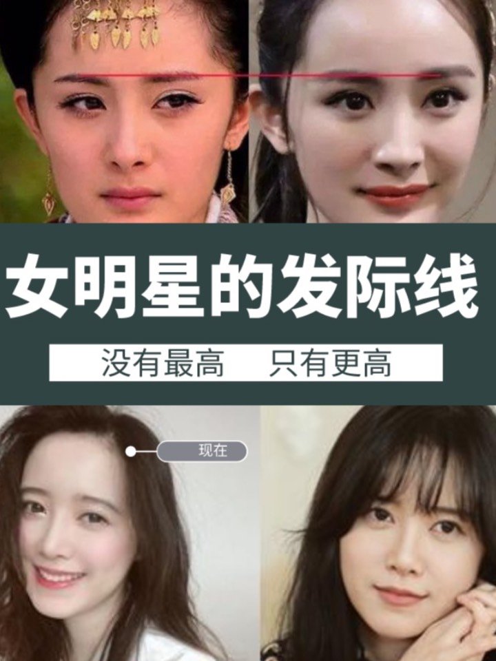 女明星的发际线也很难啊