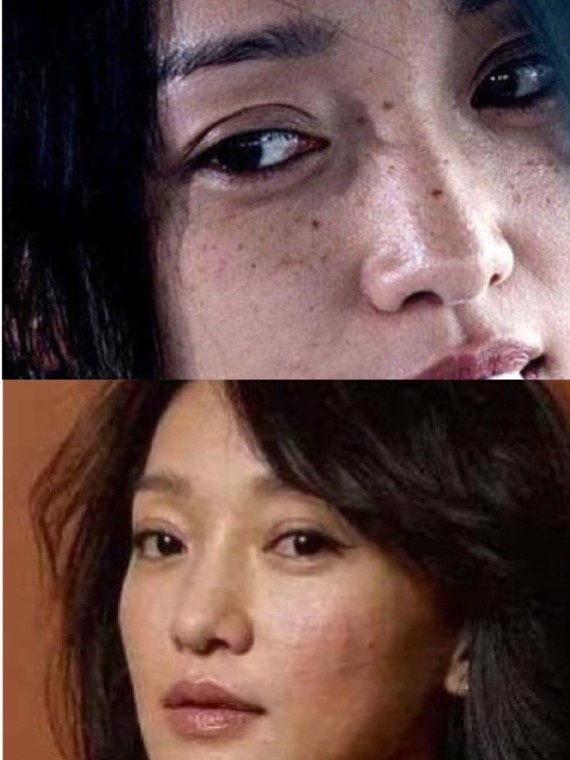 正如我们所周知的舒淇女神一样,她也长雀斑,而且她还是天生的雀斑脸