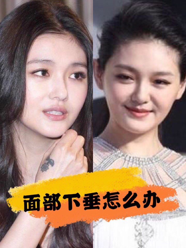 明星也会衰老岁月也在脸上留下了痕迹