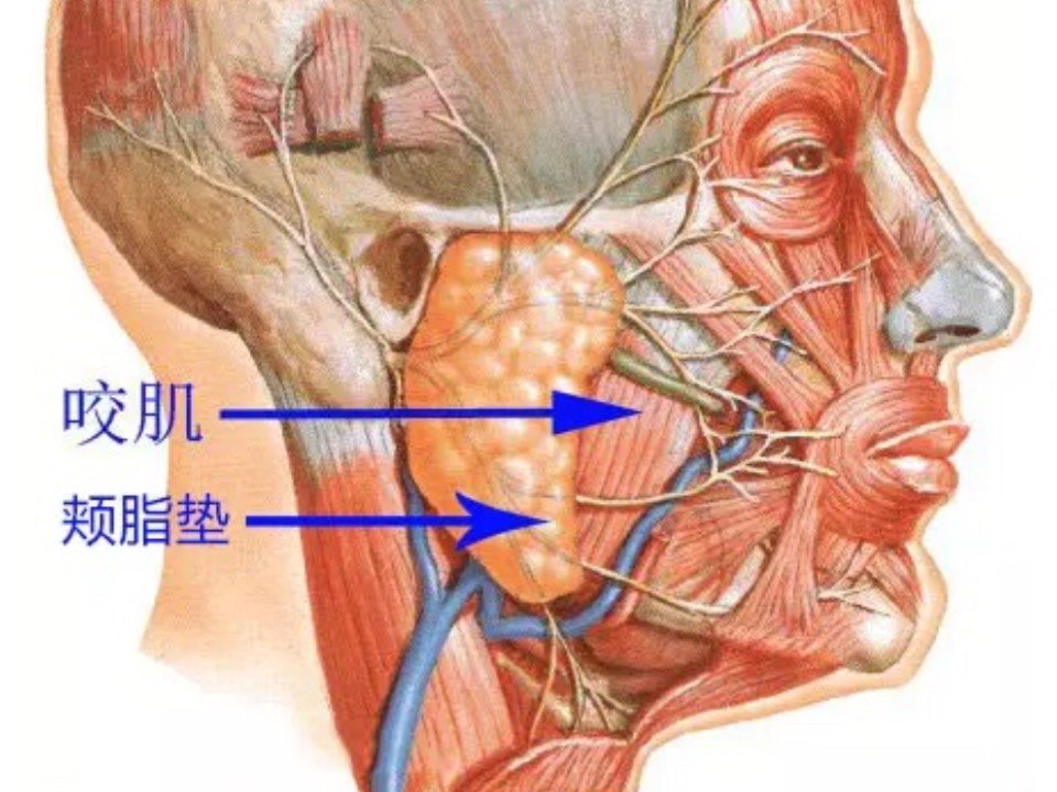 瘦脸针的改变#极简变美主义 颊脂垫位于颊部,是