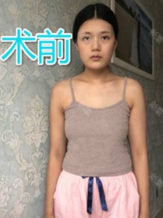 女人胸小的坏处