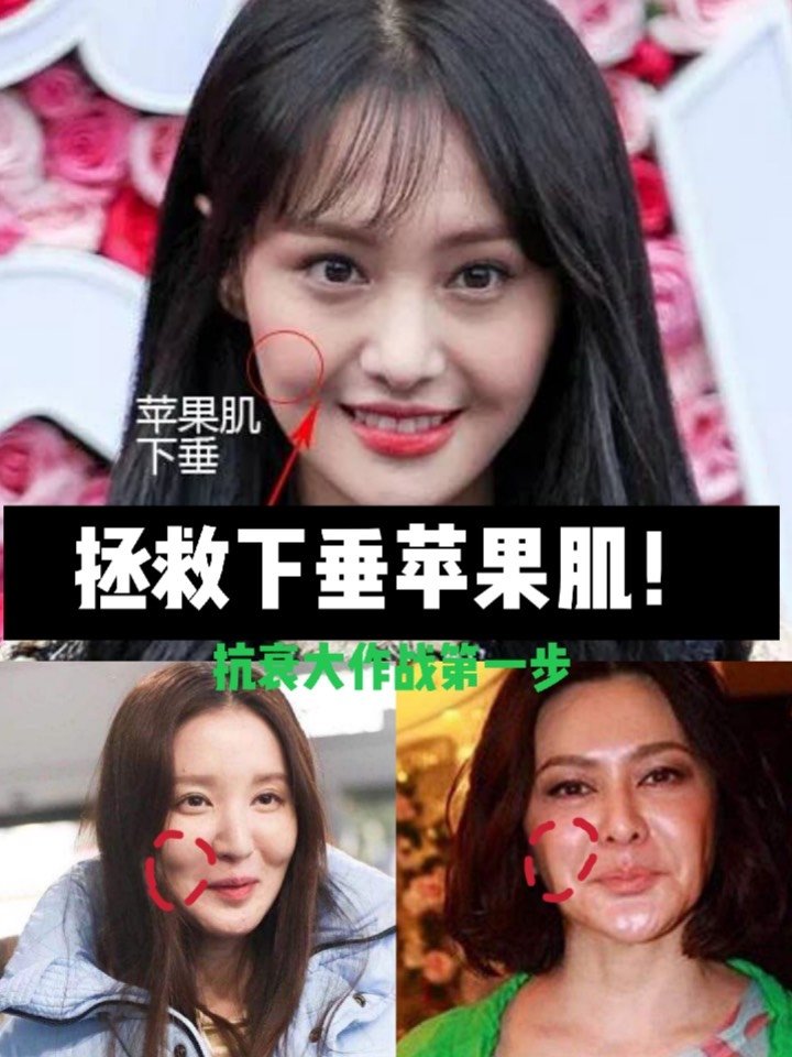 苹果肌在哪里?它为什么如此重要?