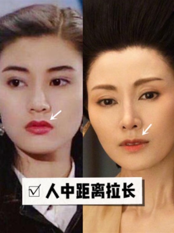 人中不包含在中庭范畴内,但对比不同长度的人中不难发现,长人中更显