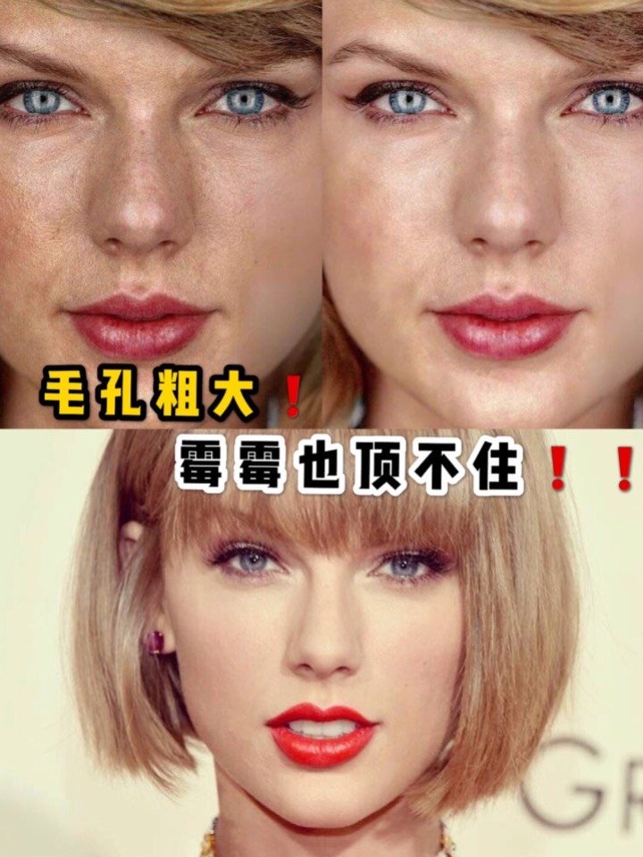 #毛孔粗大毛孔粗大�霉霉都顶不住!护肤一直都是女_圈子-新氧美容