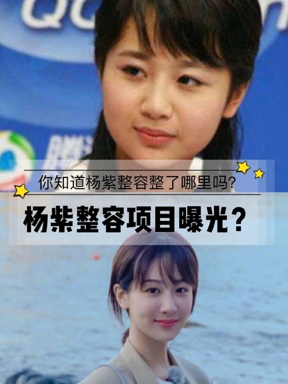 杨紫长大后的模样和小时候天差地别?疑似整容?你知道