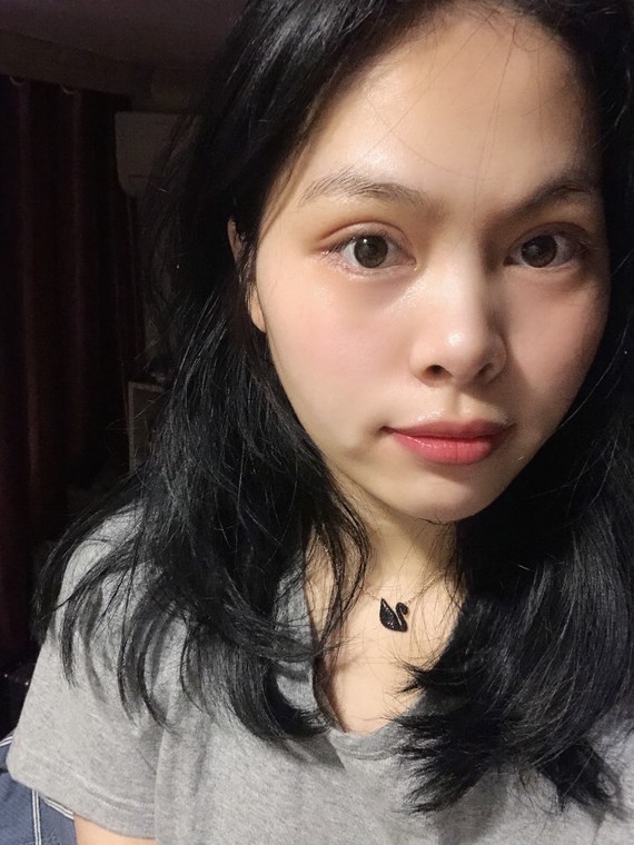 人工双眼皮和天生双眼皮怎么识别?
