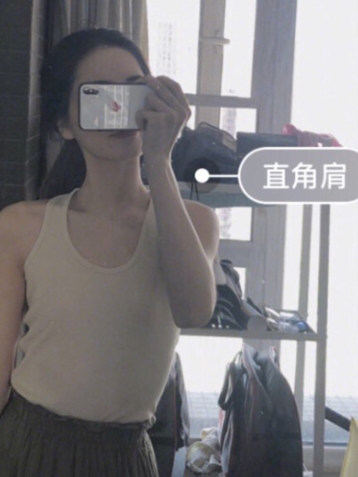 天鹅颈 直臂改造计划瘦肩针过程体验