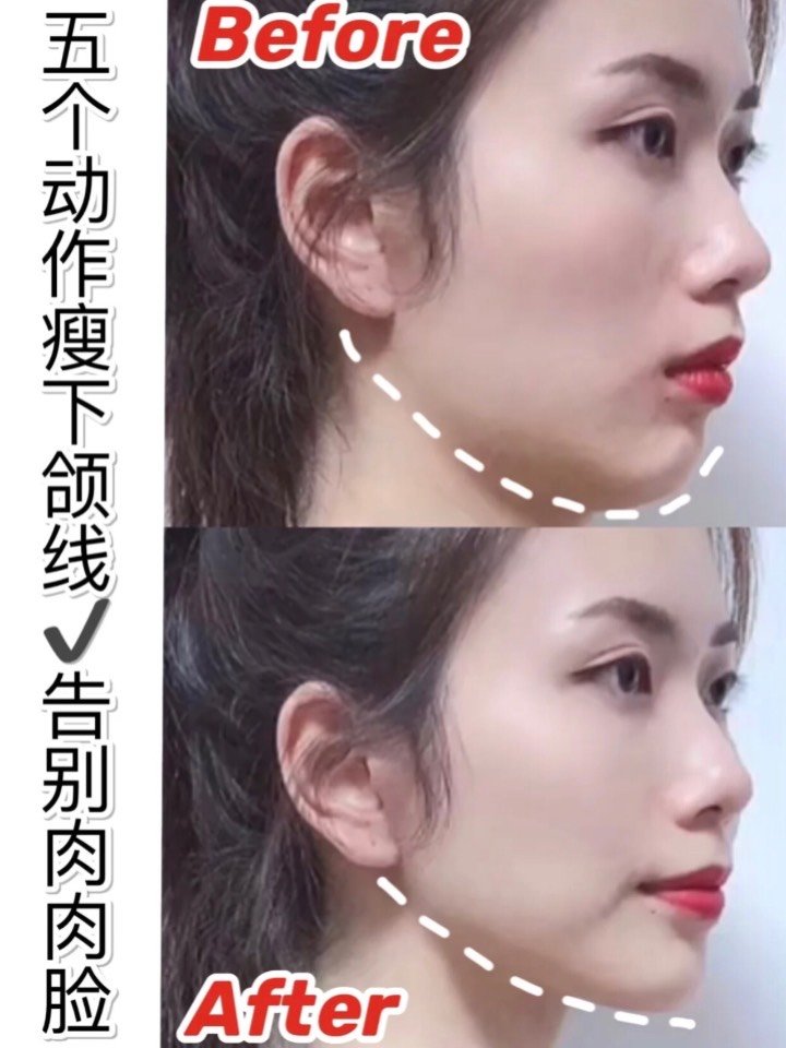 干货瘦脸心得分享: 一个月get精致 下颌线!