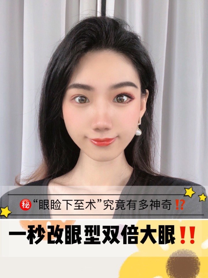 一秒改眼型神奇的眼睑下至术可以不用整容双倍放大眼