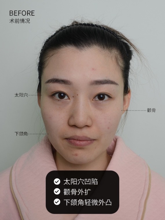 菱形脸,头小脸大怎么解决73这位宝宝希望对自己的轮廓_圈子-新氧