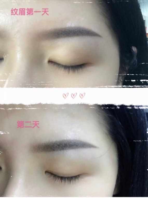 第一次纹眉后15天的结痂过程第一次纹眉体验,用了三