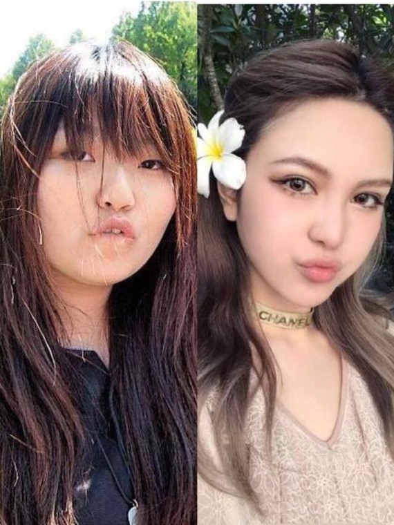 网红变脸top1周扬青,整容前后对比图都在这里