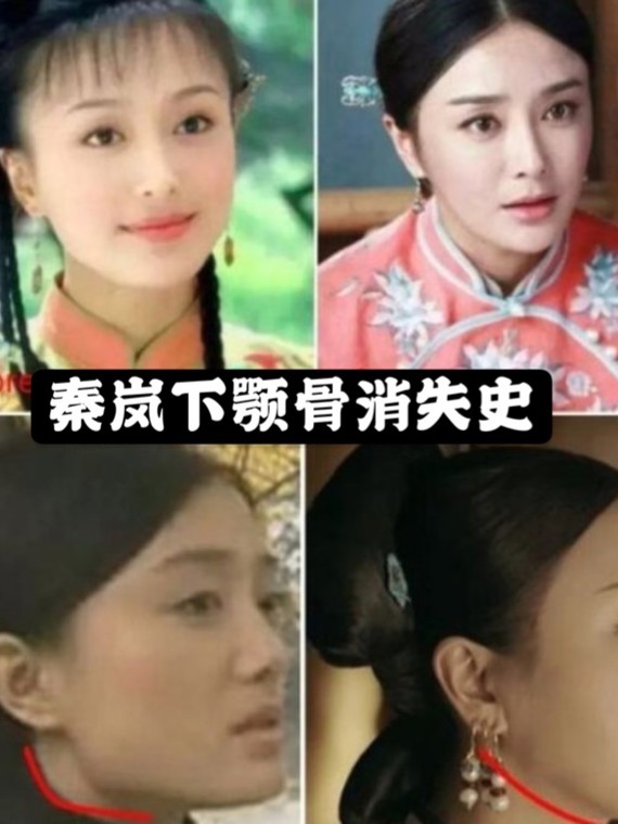 这些明星的下颌骨是组团削的吗,差距真的大