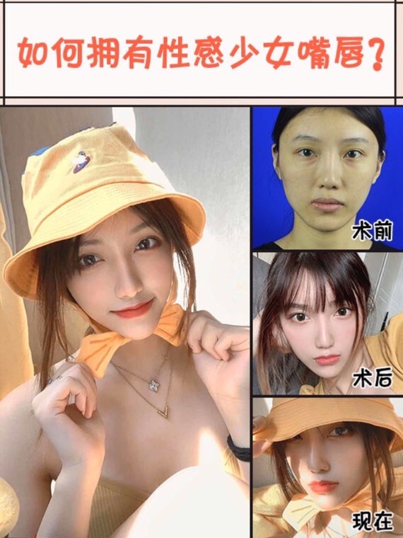 如何拥有性感少女嘴唇?