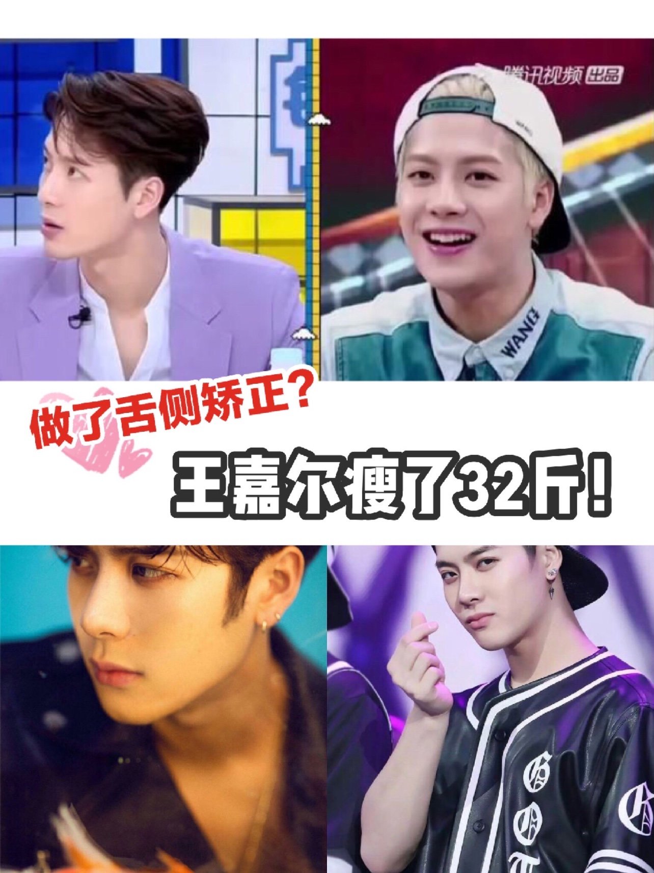 做完舌侧矫正的王嘉尔,瘦了32斤!牙齿矫正的可以减肥吗?