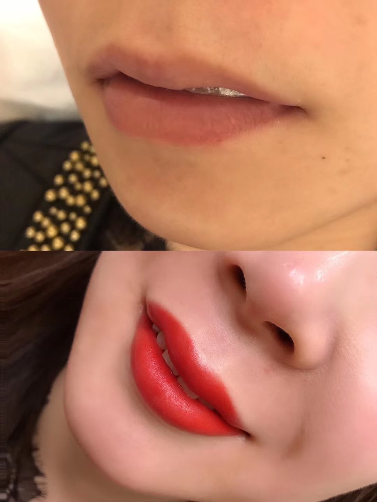 记录我的半永久唇全过程操作前唇色偏暗,上唇唇色有点_圈子-新氧美容
