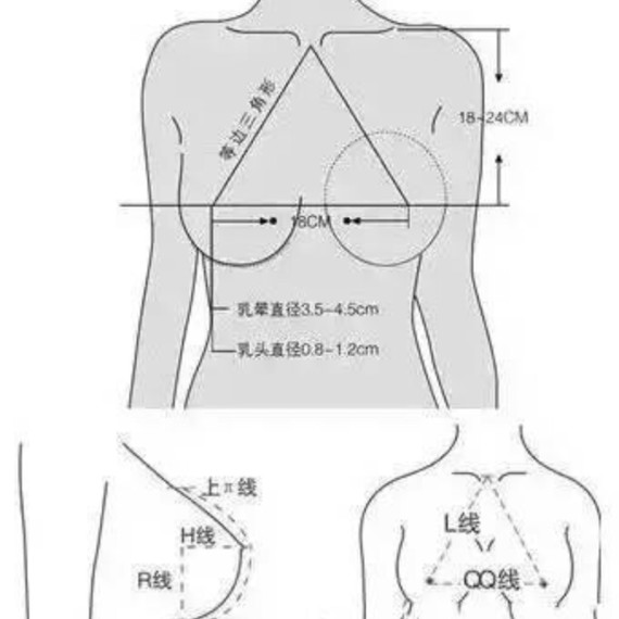 隆胸手术有所谓的黄金标准吗?乳房