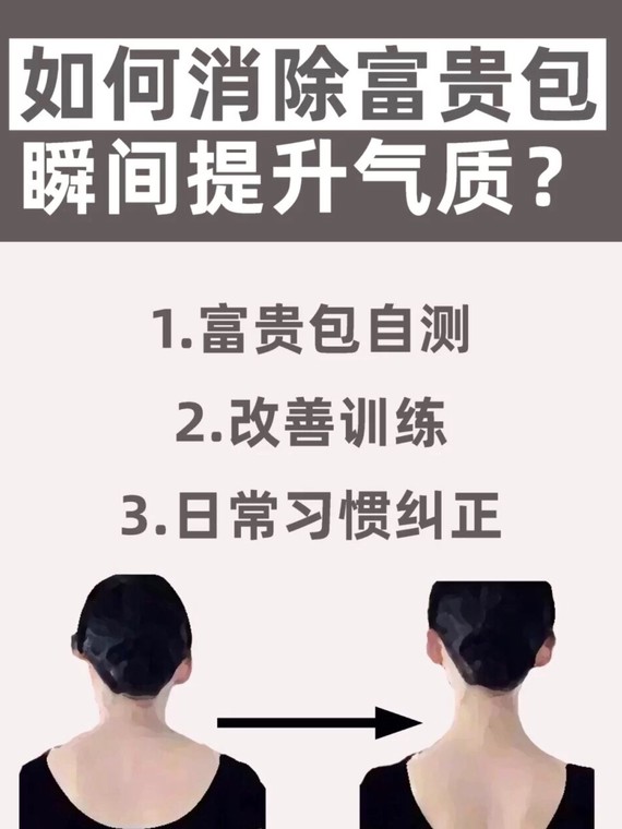 如何快速消除富贵包除了图中的一些方法,还有几个改善