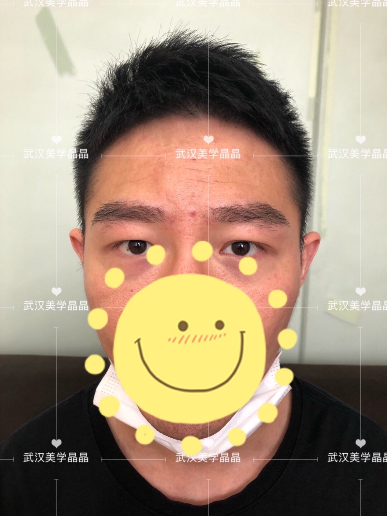 男士整形##眉毛#面相学来说:男人的眉毛,藏着一_圈子