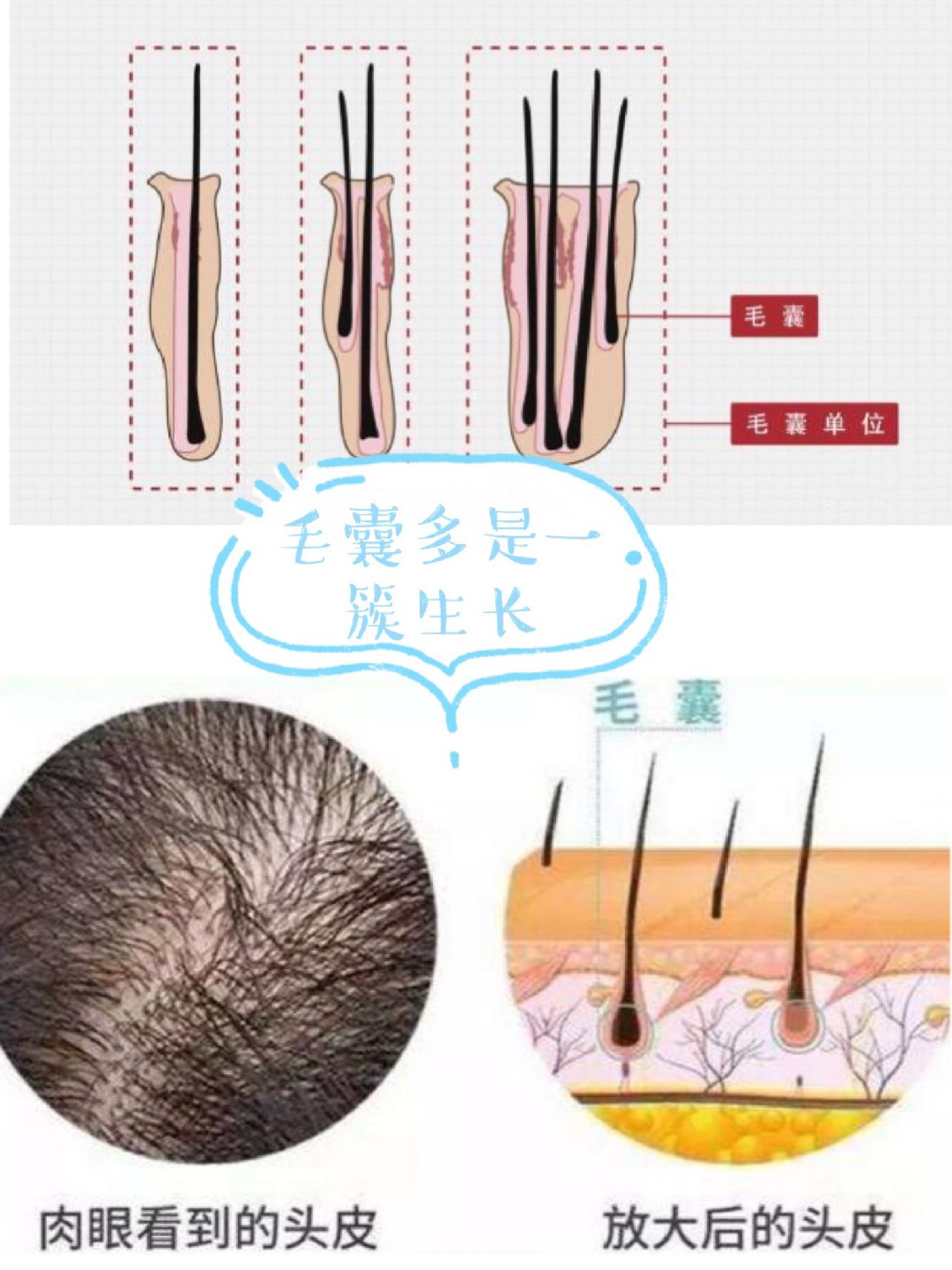 特写头部与头发和头皮高清摄影大图-千库网