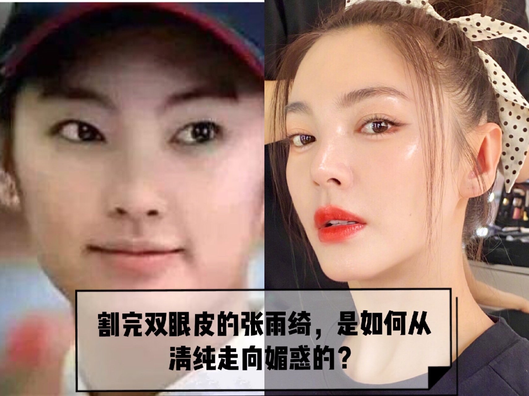 早期的张雨绮长相清纯而内敛,虽然眼睛是吊梢眼,眼角尖锐且上扬,但单