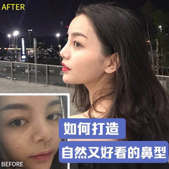 如何打造自然又好看的鼻型.