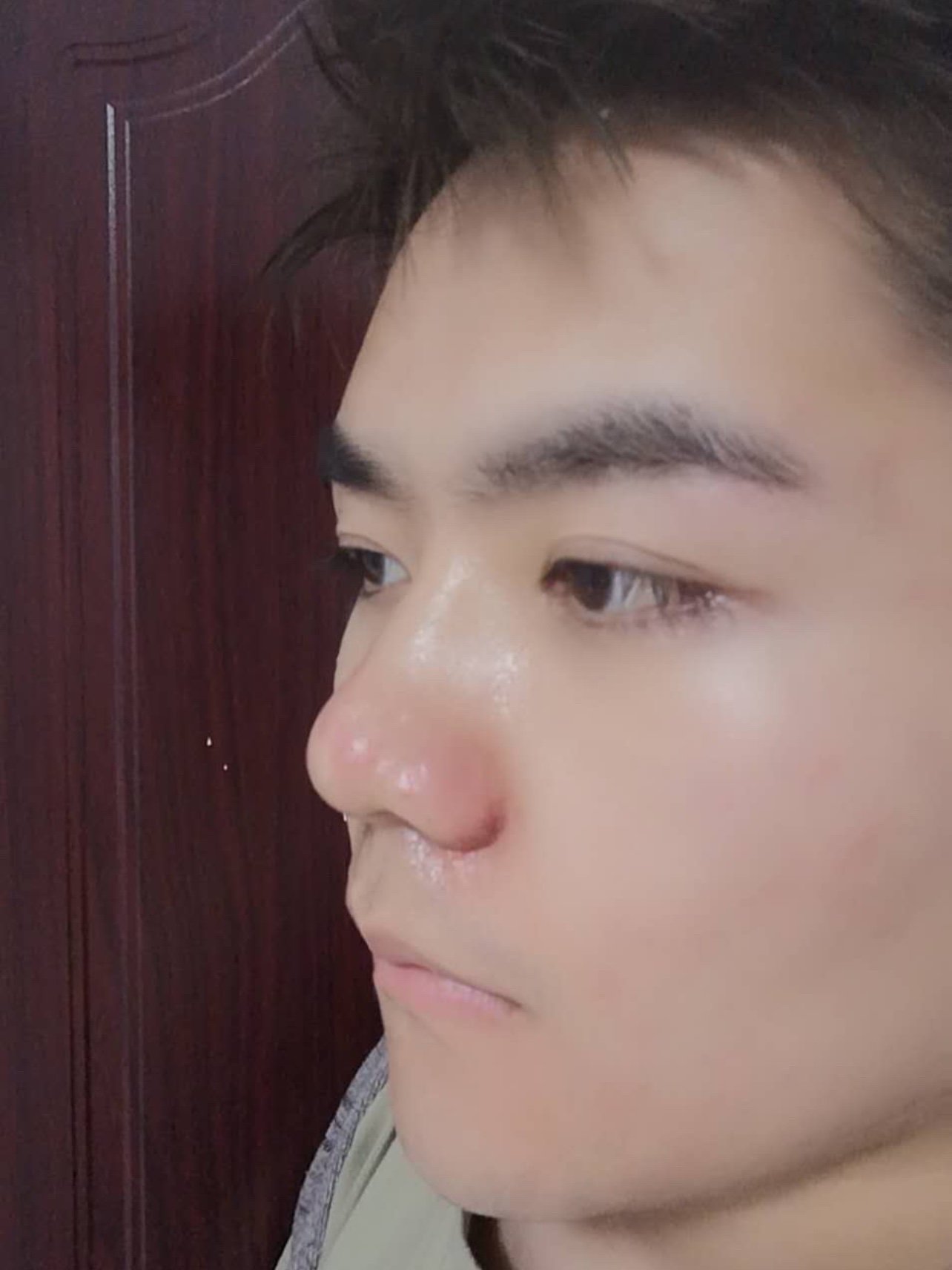 韩国优雅人整形外科——男生鼻子整容模板来了 - 哔哩哔哩