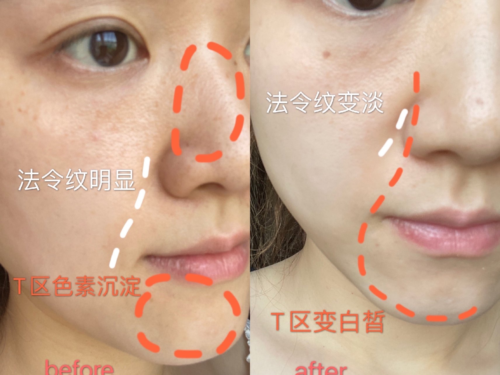 新氧体验官欧洲之星4d