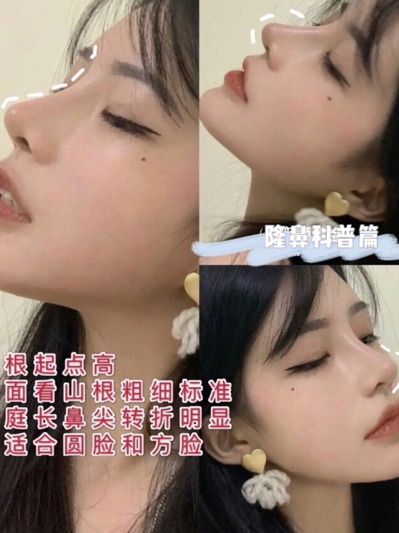 小翘鼻和精致鼻的姐妹们可以看看这篇的模板,这篇适合走韩范的女生