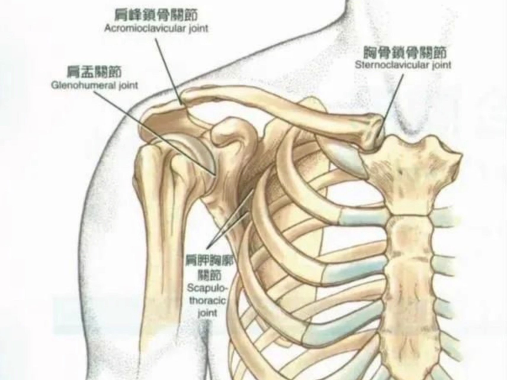 直角肩是一种病态,它的名字叫肩胛骨下回旋综合征.