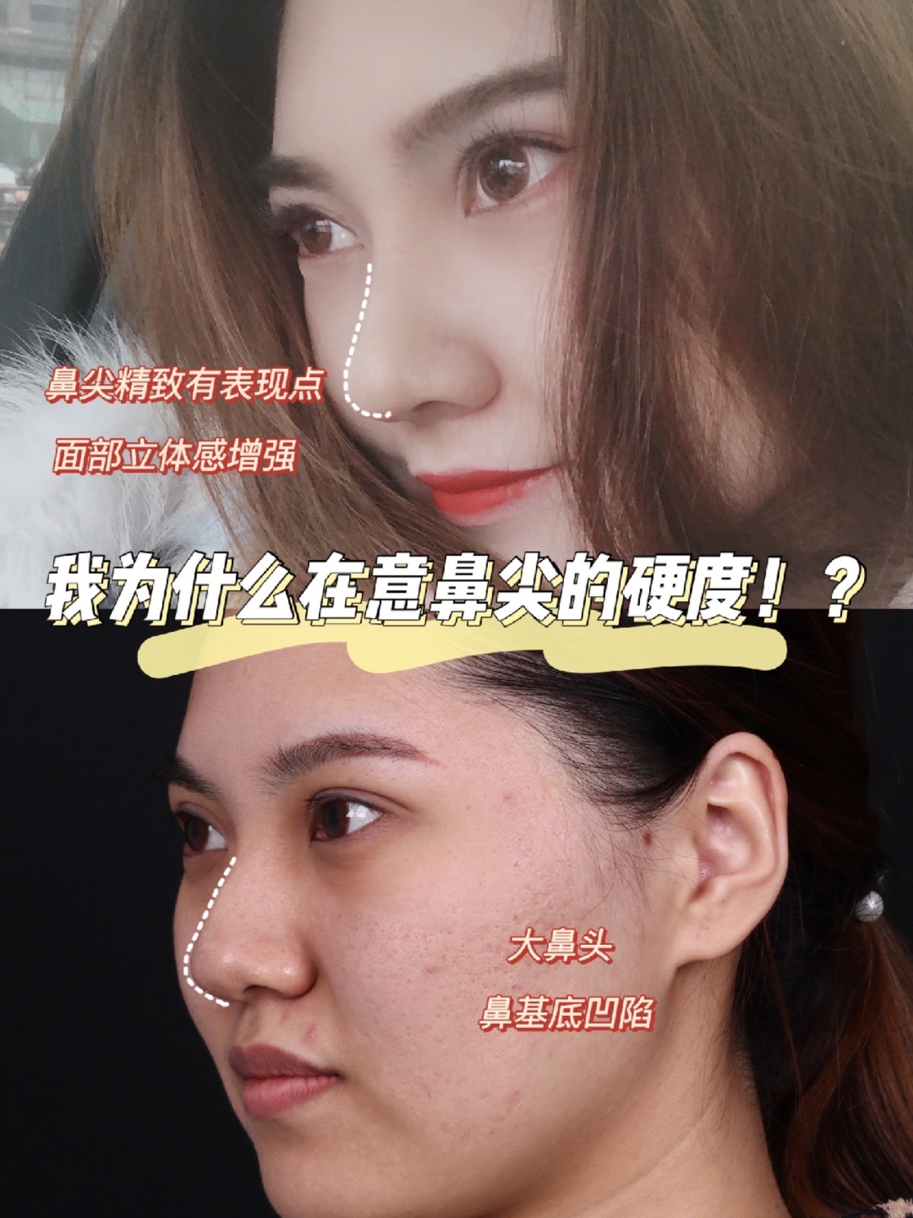 "妈生款"美鼻 案例分析