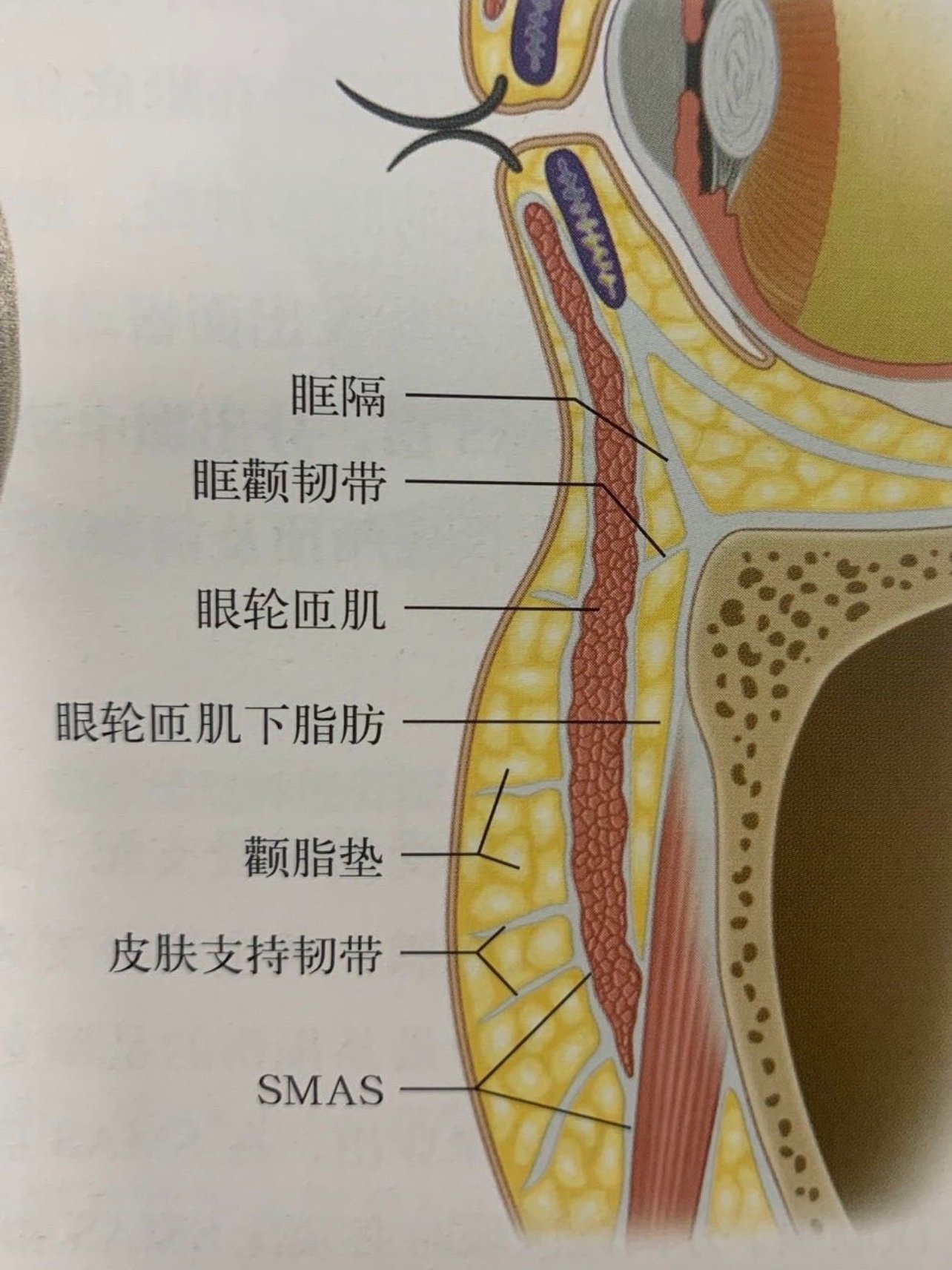 眼轮匝肌下脂肪(soof)和颧脂肪以及颊脂肪是面中部主要脂肪垫