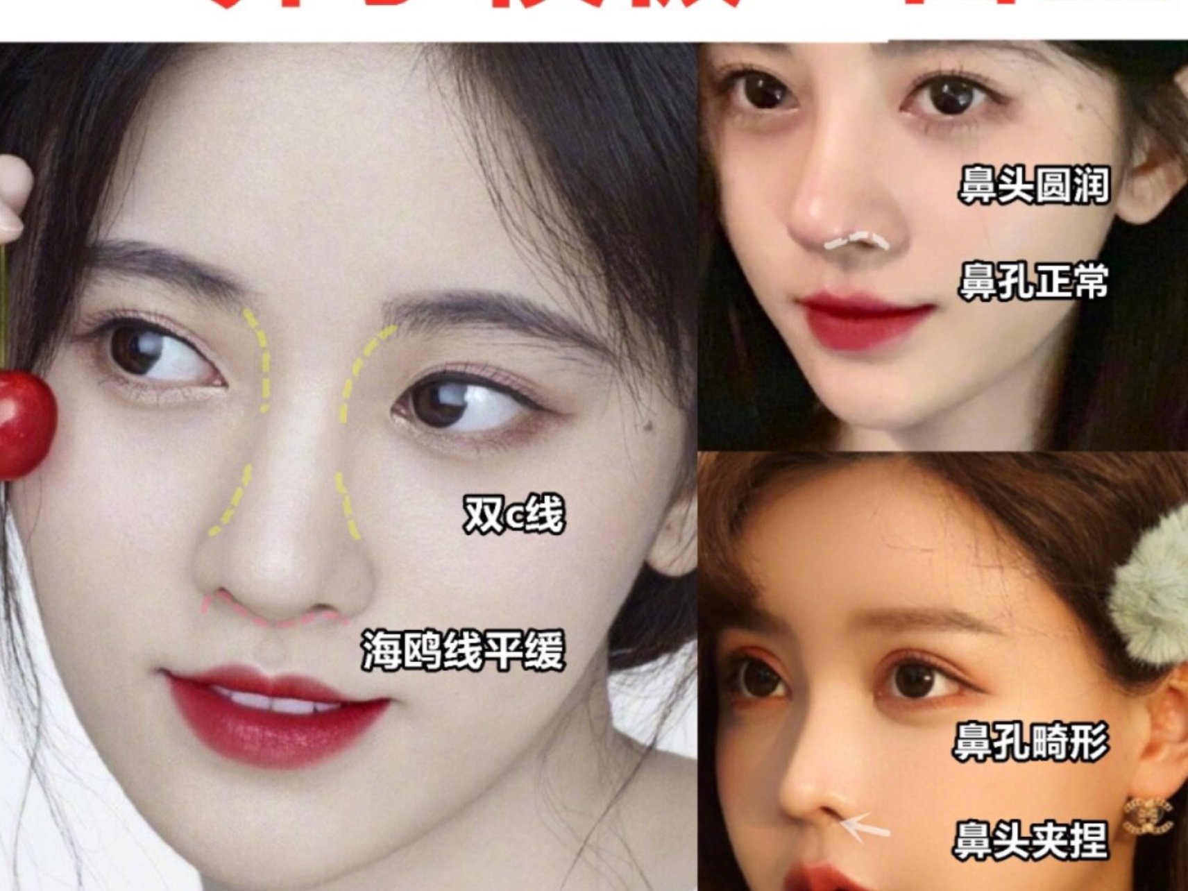 直鼻微翘模板误区避雷