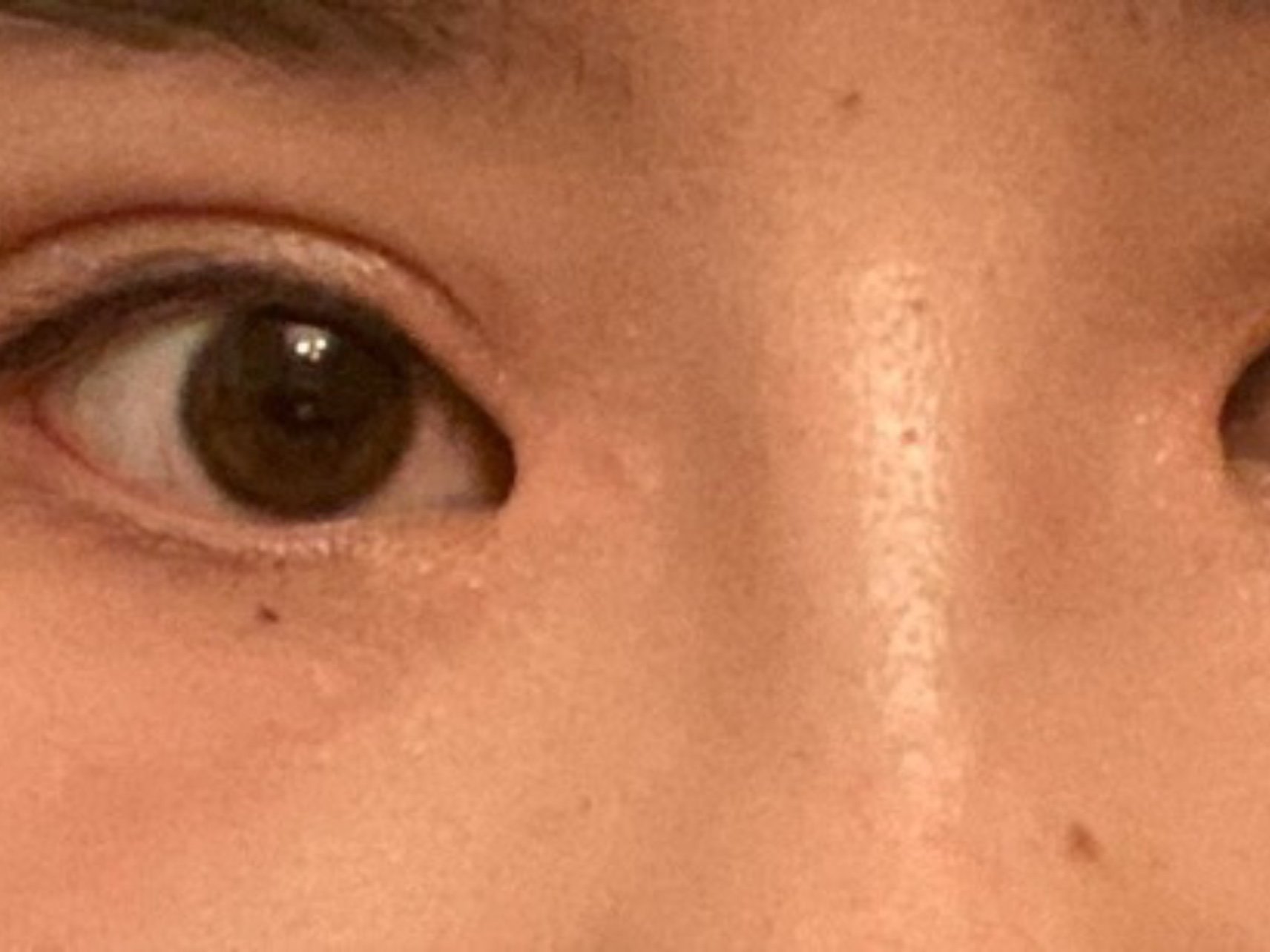 畸形眼睛!
