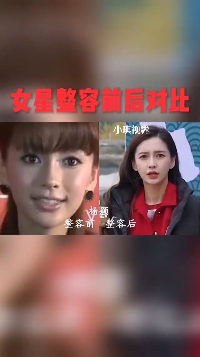 女星整容前后对比