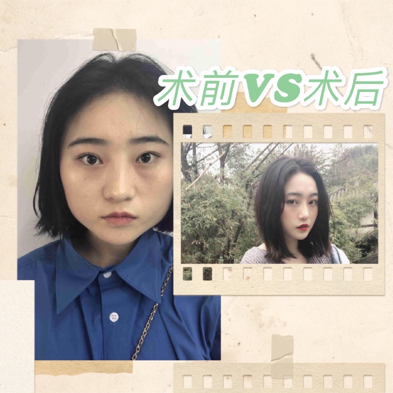 大胖脸的逆袭